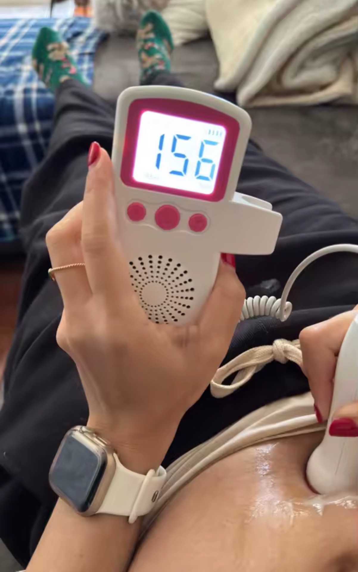 Cliente utilisant le Bébé Doppler — 156 bpm détectés